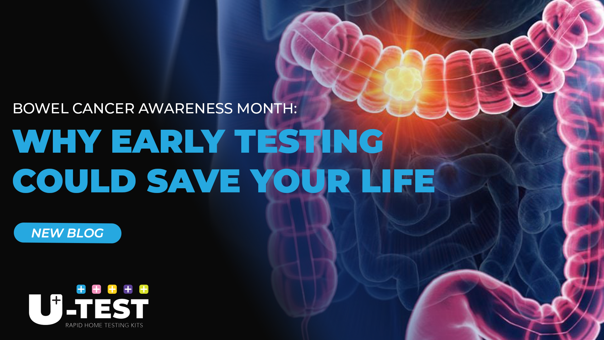 Bowel Cancer Awareness Month: Why Early Testing Could Save Your Life