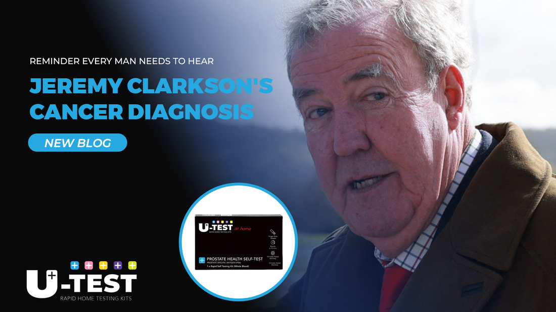 Jeremy Clarkson's Diagnosis Is a Reminder Every Man Over 40 Needs to Hear
