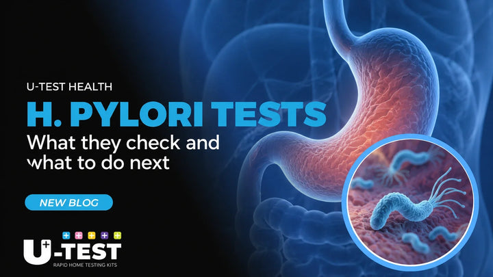 H. pylori tests: what they check and what to do next